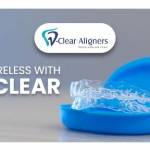 VClear Aligners Profile Picture